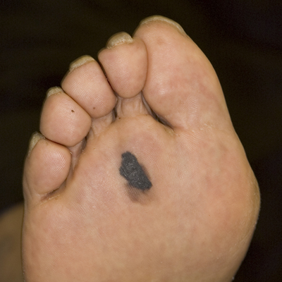 Clinical Quiz Black Sole Mole Chemist Druggist clinical quiz black sole mole