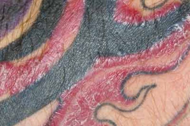 70 Free Tattoo Itchy HD Tattoo