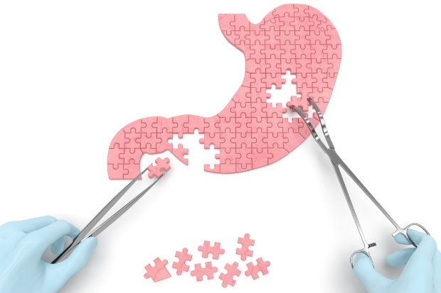 Helicobacter pylori is a bacteria that can enter the GI tract and cause peptic or duodenal ulceration Helicobacter pylori is a bacteria that can enter the GI tract and cause peptic or duodenal ulceration