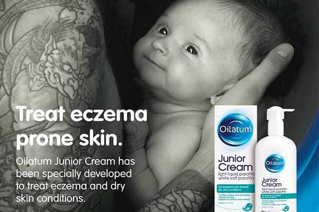 oilatum eczema cream