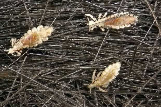Headlice Treatment Headlice Treatment