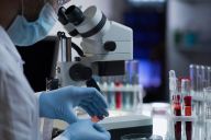 Covid 19 Superdrug Launches Phlebotomy Antibody Testing Service Chemist Druggist